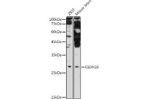 Western blot analysis of extracts of various cell lines, using CLDN16 antibody (ABIN6133646, ABIN6138679, ABIN6138680 and ABIN6225195) at 1:500 dilution. (Claudin 16 antibody  (AA 50-150))