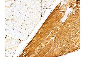 ABIN6263820 and ABIN6276785 at 1/100 staining Rat muscle tissue by IHC-P. (OLR1 antibody  (N-Term))