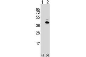 Western blot analysis of PITX1 antibody and 293 cell lysate either nontransfected (Lane 1) or transiently transfected (2) with the PITX1 gene. (PITX1 antibody  (AA 123-150))