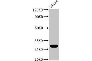 Western Blot Positive WB detected in: Rat liver tissue All lanes: RAB26 antibody at 5. (RAB26 antibody  (AA 1-58))