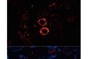 Immunofluorescence analysis of Human placenta cells using MYH11 Polyclonal Antibody at dilution of 1:100. (MYH11 antibody)