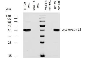 Western blotting analysis of human cytokeratin 18 using mouse monoclonal antibody DC-10 on lysates of HT-29 cell line and MOLT-4 cell line (cytokeratin non-expressing cell line, negative control) under non-reducing and reducing conditions. (Cytokeratin 18 antibody  (Biotin))