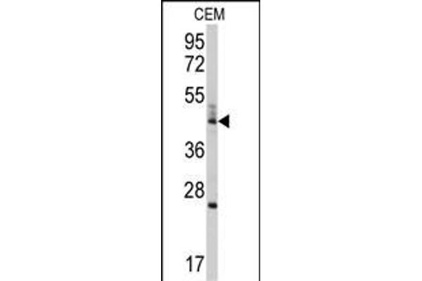 BCL2L13 antibody  (AA 197-225)