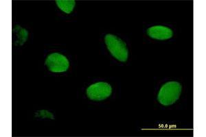 Immunofluorescence of purified MaxPab antibody to CHD2 on HeLa cell. (CHD2 antibody  (AA 1-501))