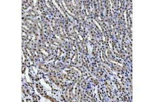 IHC analysis of HOXC4 using anti-HOXC4 antibody (ABIN7603059). (HOXC4 antibody  (Middle Region))