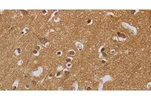 Immunohistochemistry of paraffin-embedded Human brain tissue using KIF4A Polyclonal Antibody at dilution 1:40 (KIF4A antibody)