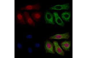 ABIN7094791 and ABIN7098842 staining Hela cells by IF/ICC. (UBA1 antibody  (Internal Region))