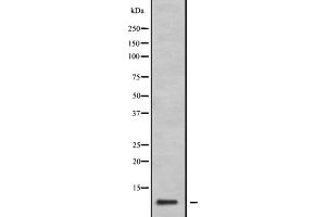 Western blot analysis of GNG11 expression in 293T lysate,The lane on the left is treated with the antigen-specific peptide.