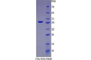 SDS-PAGE (SDS) image for C-Reactive Protein (CRP) ELISA Kit (ABIN6574221)