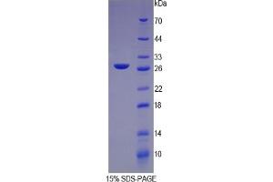 SDS-PAGE of Protein Standard from the Kit (Highly purified E. (CRP ELISA Kit)