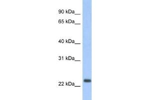 WB Suggested Anti-ND6 Antibody Titration:  0. (MT-ND6 antibody  (Middle Region))