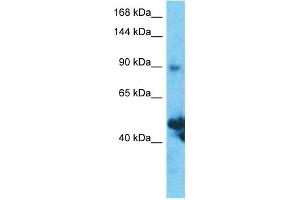 Host:  Rabbit  Target Name:  SLC39A10  Sample Type:  Thymus Tumor lysates  Antibody Dilution:  1.