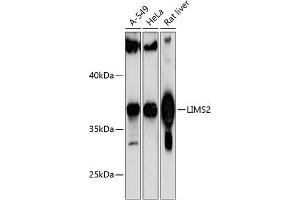 Western blot analysis of extracts of various cell lines, using LIMS2 antibody (ABIN6132166, ABIN6143236, ABIN6143237 and ABIN6217146) at 1:1000 dilution. (LIMS2 antibody  (AA 1-341))