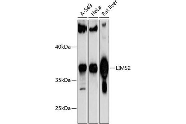 LIMS2 抗体  (AA 1-341)