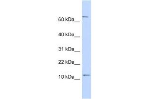 WB Suggested Anti-TRA16 Antibody Titration: 0. (NR2C2AP antibody  (N-Term))