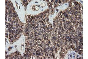 Image no. 1 for anti-Protein Disulfide Isomerase Family A, Member 3 (PDIA3) antibody (ABIN1498107) (PDIA3 antibody)