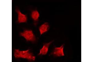Immunofluorescence (fixed cells) (IF/ICC) image for anti-Checkpoint Kinase 1 (CHEK1) (pSer301) antibody (ABIN6256255)