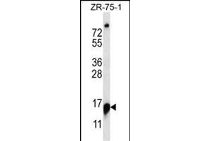R Antibody (C-term) (ABIN657030 and ABIN2846204) western blot analysis in ZR-75-1 cell line lysates (35 μg/lane).