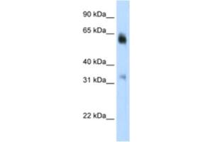 Western Blotting (WB) image for anti-Lysine (K)-Specific Demethylase 4D (KDM4D) antibody (ABIN2461887)