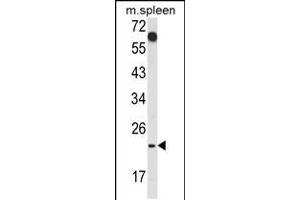 Western blot analysis of CD7 Antibody in mouse spleen tissue lysates (35ug/lane) (CD7 antibody  (AA 65-91))
