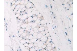 Detection of NPM1 in Mouse Adipose tissue Tissue using Polyclonal Antibody to Nucleophosmin 1 (NPM1) (NPM1 antibody  (AA 212-292))