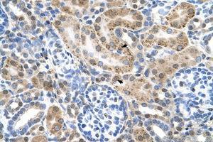 Image no. 1 for anti-Organic Cation Transporter 3 (OCT3) (AA 46-95) antibody (ABIN6736661) (SLC22A3 antibody  (AA 46-95))