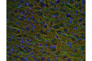Indirect immunostaining of PFA fixed mouse brain section with anti-GAP 43 (dilution 1 : 500; red) and rabbit anti-MAP 2 (ABIN1742387, dilution 1 : 500; green).