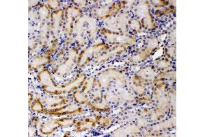 IHC analysis of AMFR using anti-AMFR antibody (ABIN4886455). (AMFR antibody  (AA 553-643))