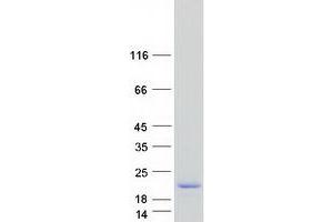 Chromosome X Open Reading Frame 27 (CXORF27) protein (Myc-DYKDDDDK Tag)