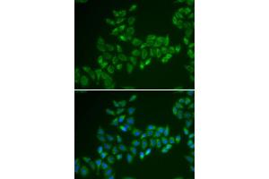 Immunofluorescence analysis of HeLa cell using CRAT antibody. (CRAT antibody)
