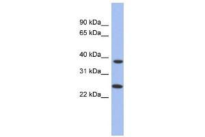 WB Suggested Anti-MTRF1L Antibody Titration: 0. (MTRF1L antibody  (N-Term))