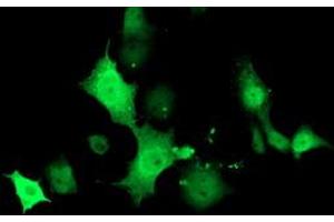 Anti-TMOD1 mouse monoclonal antibody (ABIN2454778) immunofluorescent staining of COS7 cells transiently transfected by pCMV6-ENTRY TMOD1 (RC201134). (Tropomodulin 1 antibody)