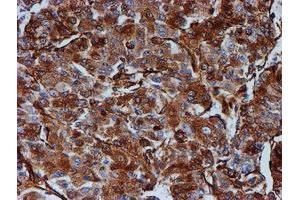 Immunohistochemistry (IHC) image for anti-Tubulin beta 4a (TUBB4A) antibody (ABIN1501579) (TUBB4 antibody)