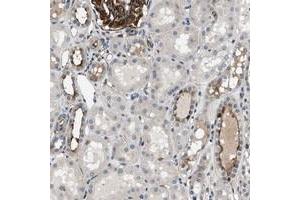 Immunohistochemical staining of human kidney with GPRC5B polyclonal antibody  shows membranous positivity in glomeruli at 1:50-1:200 dilution. (GPRC5B antibody)