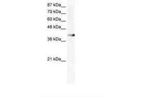 Image no. 1 for anti-Zinc Finger Protein 556 (ZNF556) (AA 322-371) antibody (ABIN202562) (ZNF556 antibody  (AA 322-371))