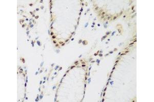 Immunohistochemistry of paraffin-embedded Human stomach using PPAN Polyclonal Antibody at dilution of 1:200 (40x lens). (PPAN antibody)