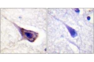 Immunohistochemistry analysis of paraffin-embedded human brain tissue, using BAD (Ab-134) Antibody. (BAD antibody  (AA 100-149))