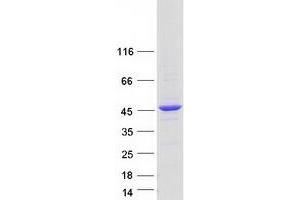 Western Blotting (WB) image for TBC1 Domain Family, Member 20 (TBC1D20) protein (Myc-DYKDDDDK Tag) (ABIN2733261)