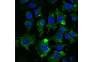 Immunofluorescence (IF) image for anti-CD63 (CD63) (AA 120-175) antibody (ABIN1440014)