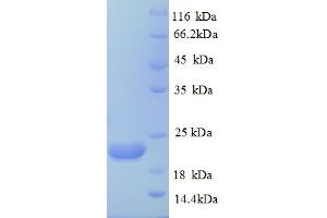 SDS-PAGE (SDS) image for Caspase 8 (CASP8) (AA 217-479) protein (His tag) (ABIN4984215) (Caspase 8 Protein (CASP8) (AA 217-479) (His tag))
