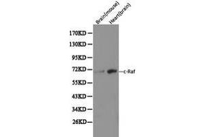 Western Blotting (WB) image for anti-V-Raf-1 Murine Leukemia Viral Oncogene Homolog 1 (RAF1) (C-Term) antibody (ABIN1874535) (RAF1 antibody  (C-Term))