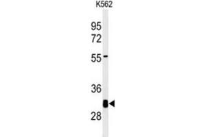 Western Blotting (WB) image for anti-Potassium Channel Tetramerisation Domain Containing 7 (KCTD7) antibody (ABIN3002217)