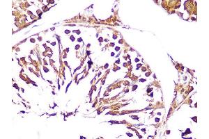 Immunohistochemistry of paraffin-embedded rat testis using UCHL3 Rabbit mAb (ABIN1682628, ABIN3015461, ABIN3015462 and ABIN7101429) at dilution of 1:100 (40x lens). (UCHL3 antibody)
