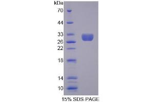SDS-PAGE analysis of Human MECP2 Protein. (MECP2 Protein)