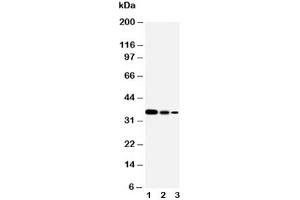 Western Blotting (WB) image for anti-SMAD, Mothers Against DPP Homolog 2 (SMAD2) (N-Term) antibody (ABIN3032617)