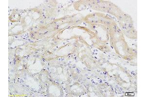 Formalin-fixed and paraffin embedded rat kidney labeled with Anti Endomucin Polyclonal Antibody, Unconjugated (ABIN1385912) at 1:200 followed by conjugation to the secondary antibody and DAB staining (Endomucin antibody  (AA 21-120))