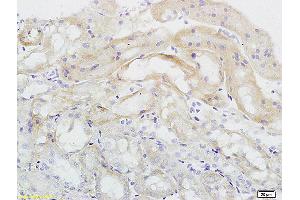 Formalin-fixed and paraffin embedded rat kidney labeled with Anti Endomucin Polyclonal Antibody, Unconjugated (ABIN1385912) at 1:200 followed by conjugation to the secondary antibody and DAB staining