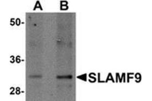 Western blot analysis of SLAMF9 in mouse kidney tissue lysate with SLAMF9 antibody at (A) 1 and (B) 2 μg/ml. (SLAMF9 antibody  (C-Term))