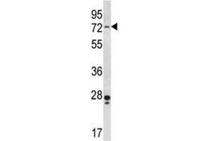 PAK4 antibody  (AA 187-216)