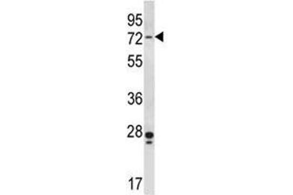 PAK4 antibody  (AA 187-216)